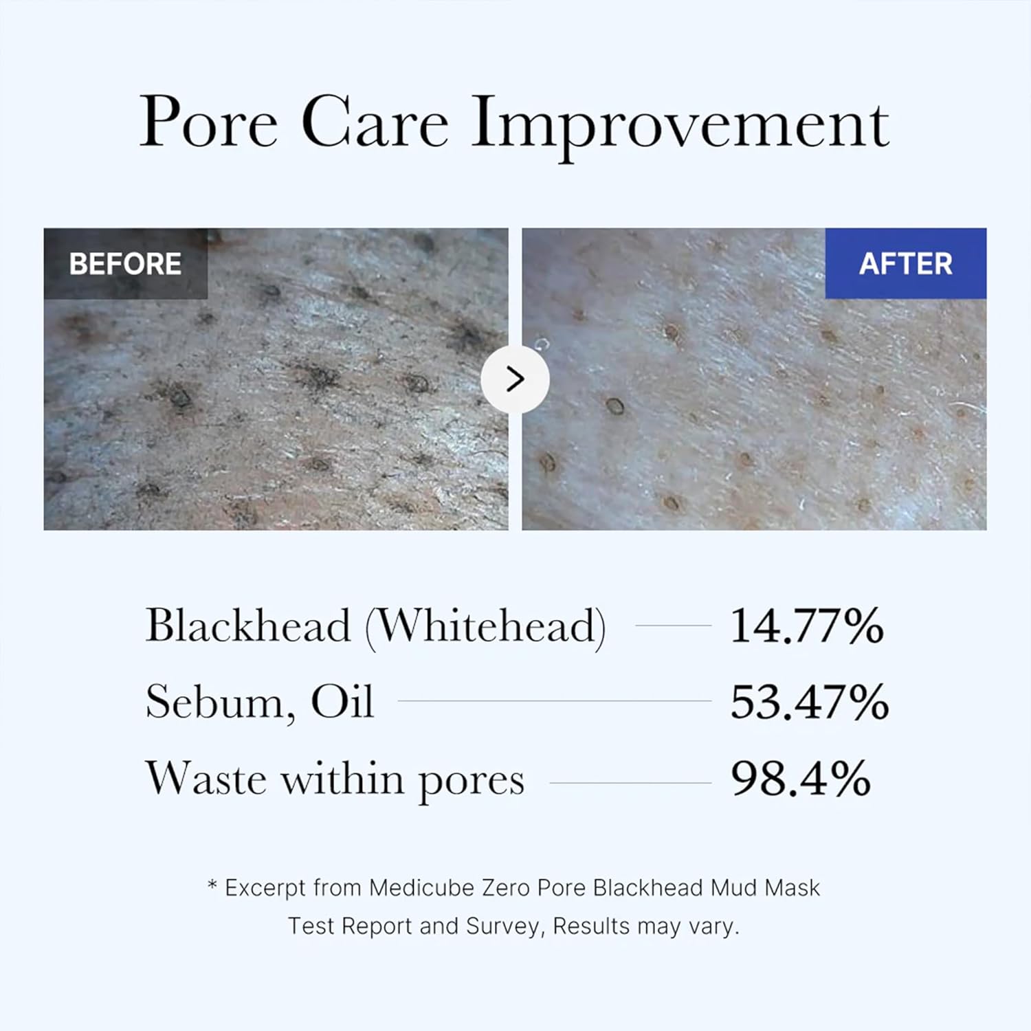 Medicube Zero Pore Blackhead Mud Mask 100 g — vue 3