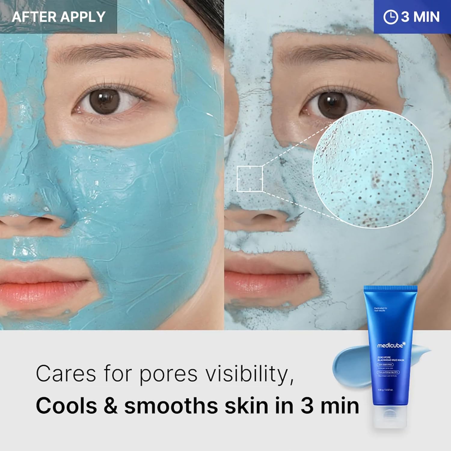 Medicube Zero Pore Blackhead Mud Mask 100 g — vue 4