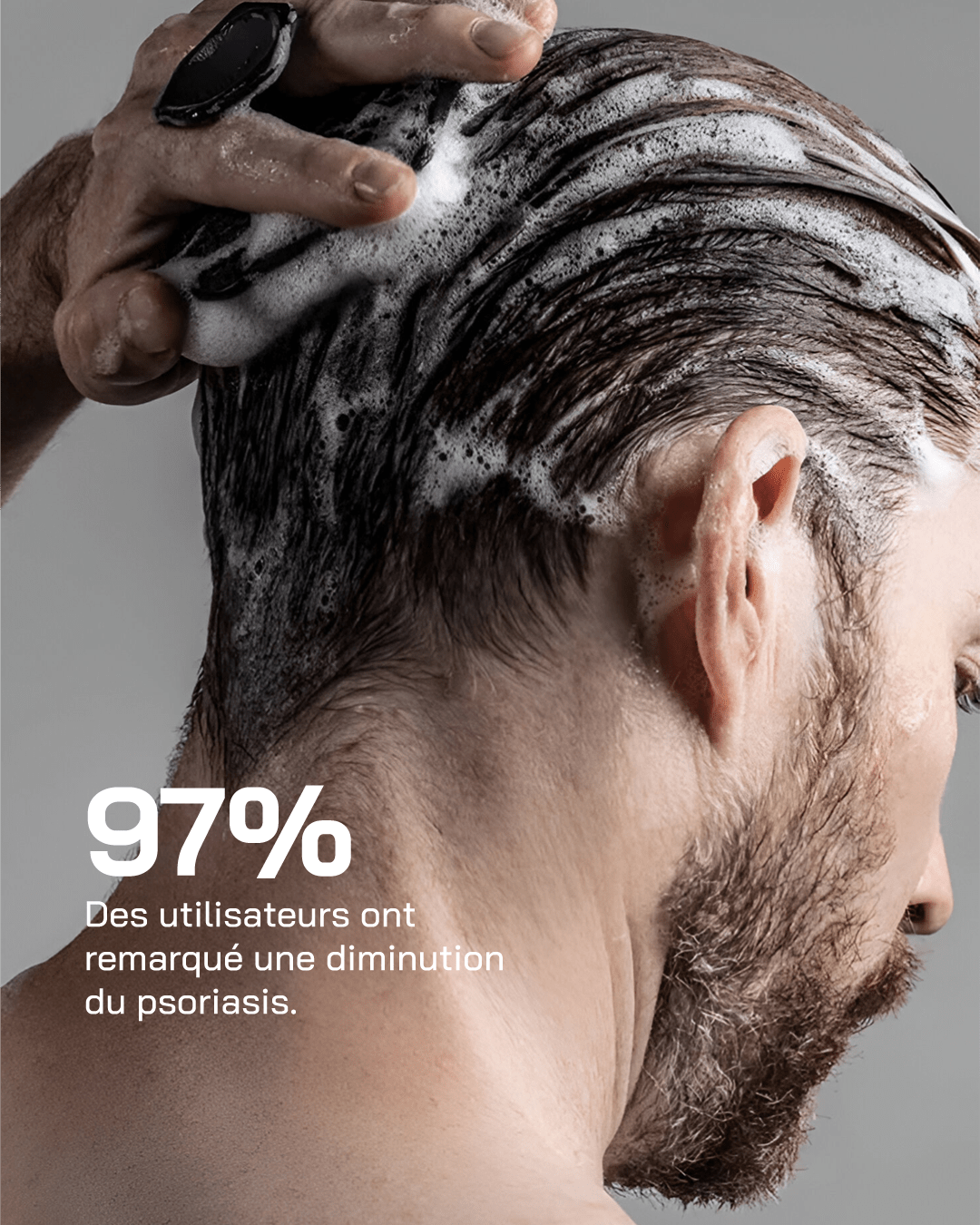Touché Shampooing Anti-Psoriasis 250 ml — vue 5